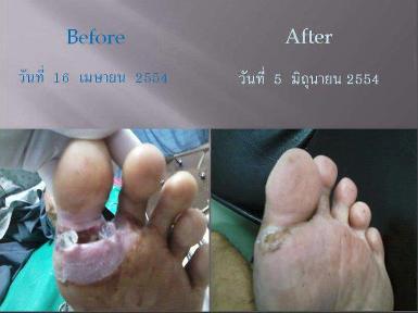 ผลลัพธ์จากลูกค้าที่ใช้ผลิตภัณฑ์จริง